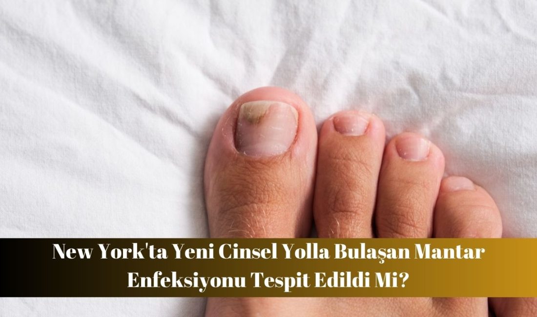 İlk Vaka Teşpit Ed